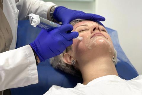 Skinpen precision microneedling 